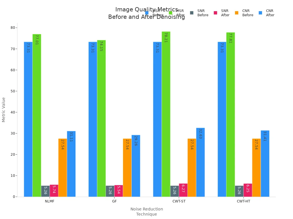 Bar chart comparing MSR, SNR, and CNR before and after denoising for four noise reduction methods