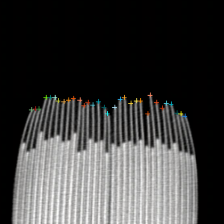 No More Guesswork: AI-Powered CT Overhang Measurement for Battery Cells